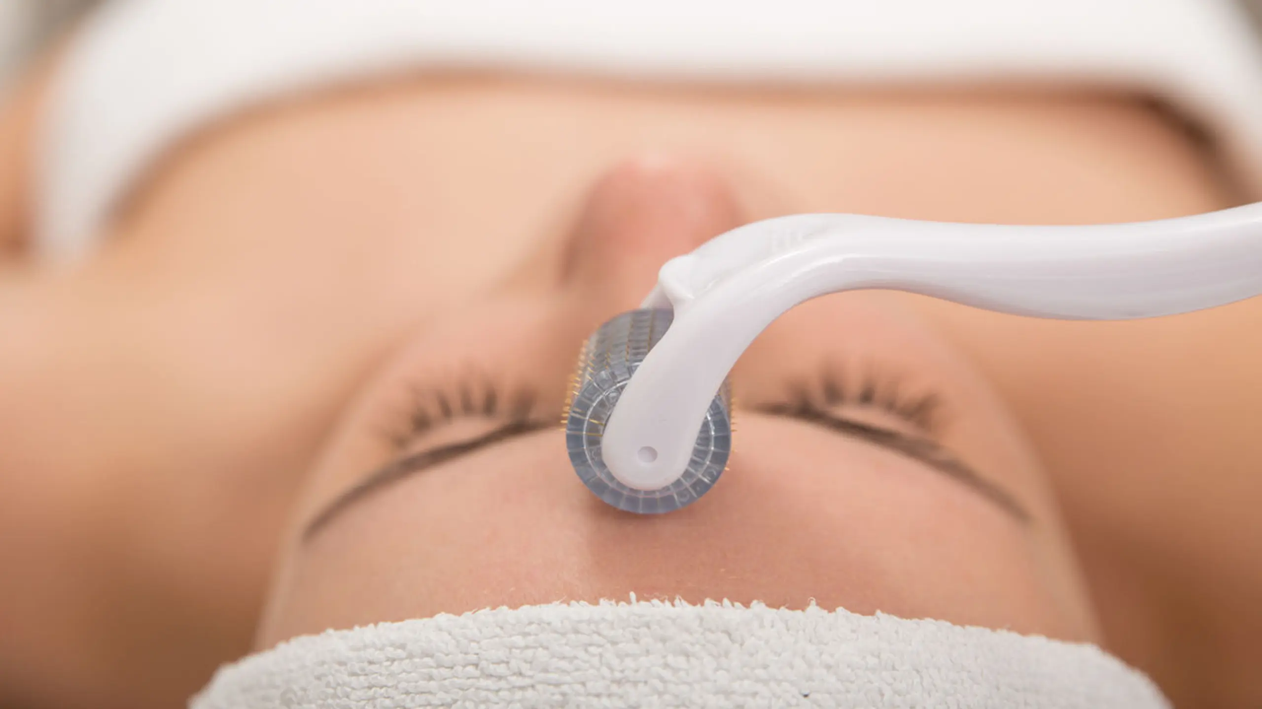 Microneedling-Roller