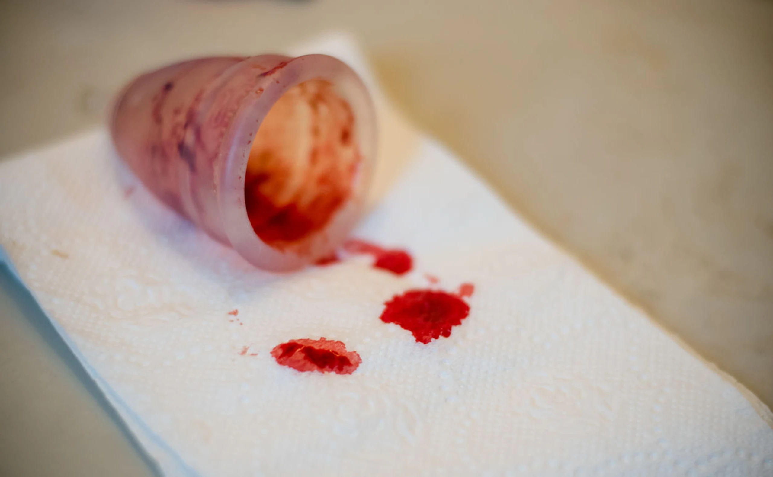 Menstruation und Frauengesundheit: Bei diesen Symptomen rund um deine Periode solltest du aufmerksam werden