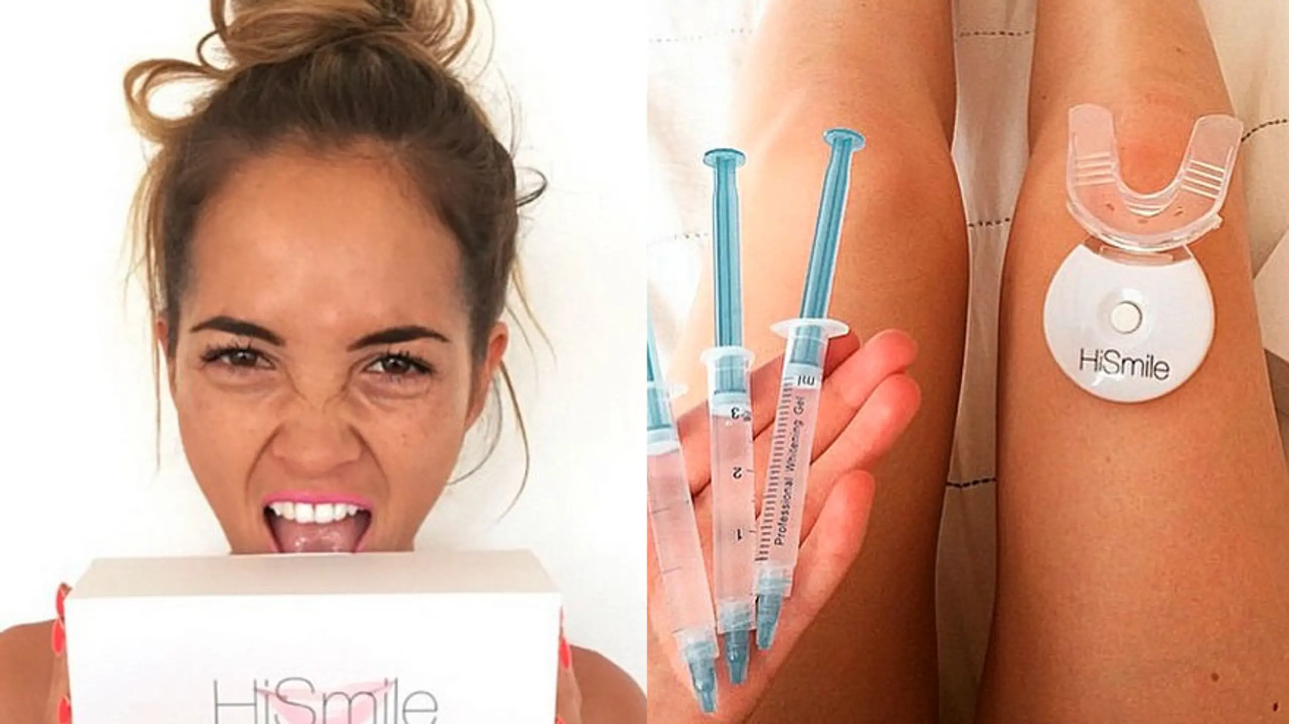 Im Test: HiSmileTeeth Bleaching